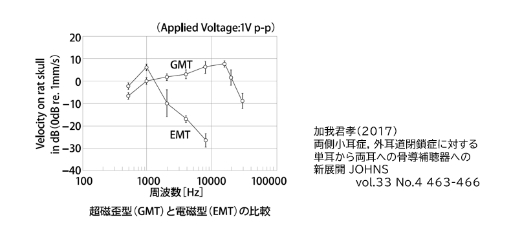 ABR(聴性能感反応)検査